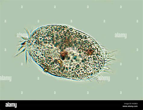  ヤスギゾウ！微細な毛で水の中を優雅に舞う、美しい Ciliophora の仲間